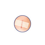 Wound Closure Adhesive Strips(1.2cm*10cm) - Image 2